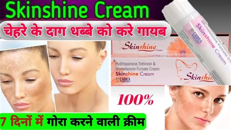 Skinshine Cream in hindi (स्किनशाइन क्रीम) की जानकारी, लाभ,。